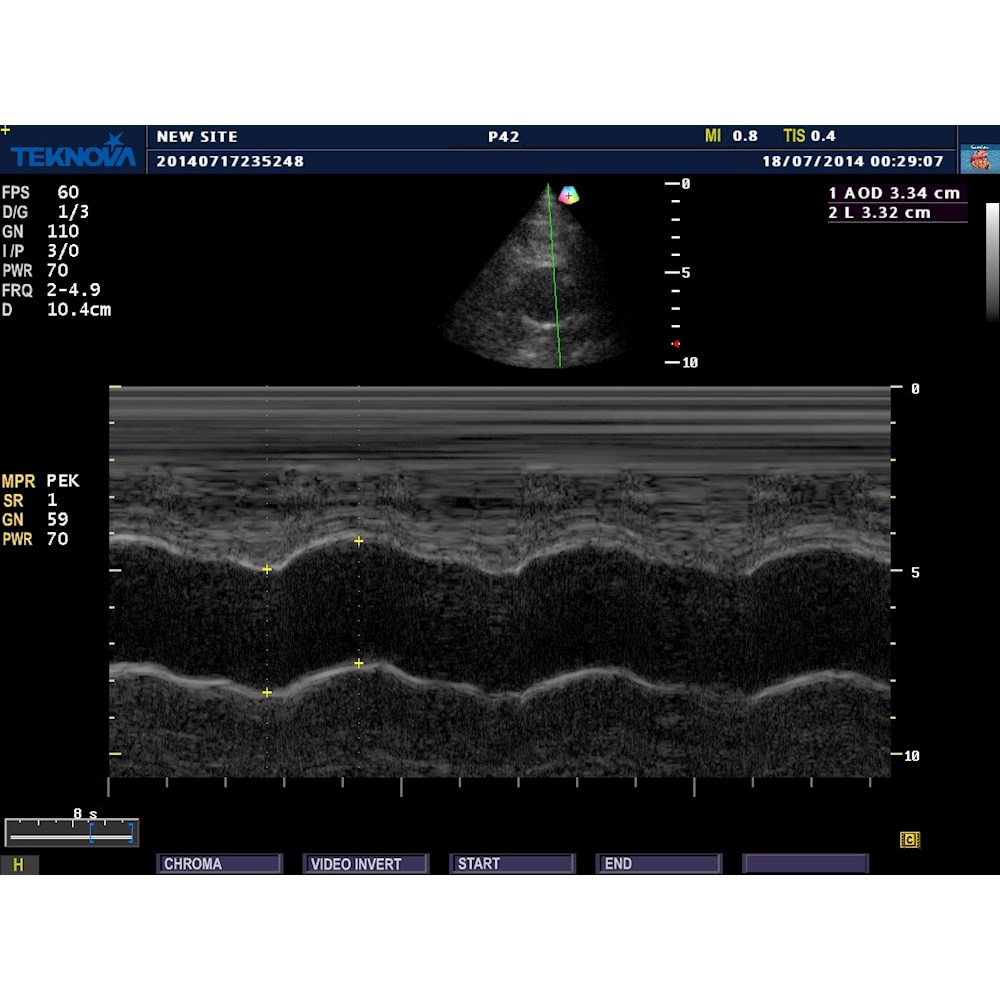 Ultrasonografy stacjonarne wielonarządowe - USG Teknova TH 5500 Expert