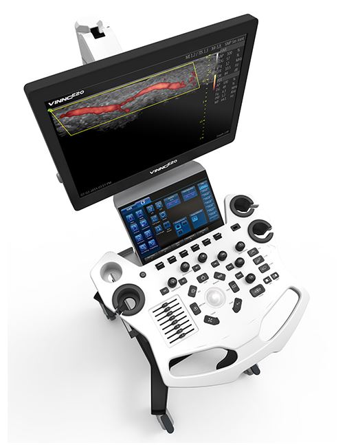 Ultrasonografy stacjonarne wielonarządowe - USG Vinno Vinno E20