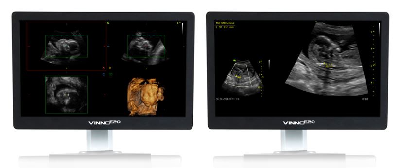 Ultrasonografy stacjonarne wielonarządowe - USG Vinno Vinno E20