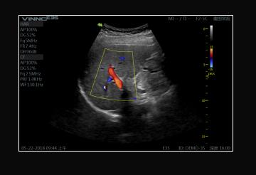 Ultrasonografy stacjonarne wielonarządowe - USG Vinno VINNO E35