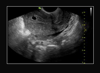 Ultrasonografy stacjonarne wielonarządowe - USG Vinno VINNO E35