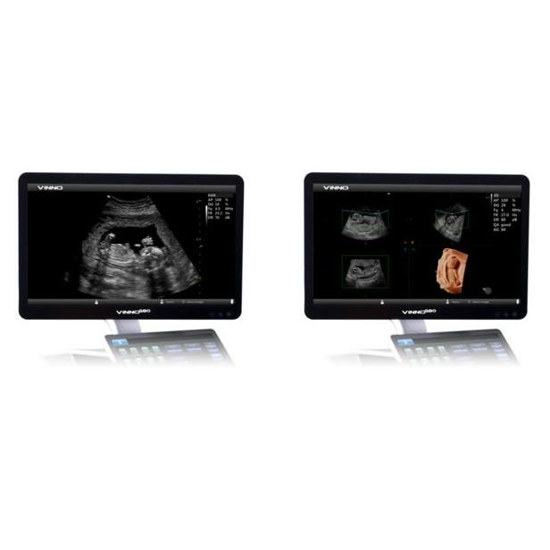 Ultrasonografy stacjonarne wielonarządowe - USG Vinno Vinno M80