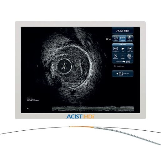 Ultrasonografy wewnątrznaczyniowe - IVUS Acist HDi