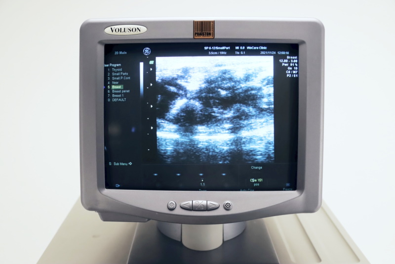 Ultrasonografy wielonarządowe używane B/D GE Voluson 730 PRO - Praiston rekondycjonowany