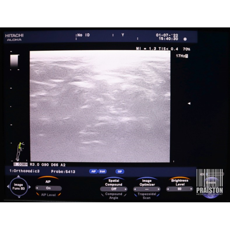 Ultrasonografy wielonarządowe używane B/D Hitachi Aloka F37 - Praiston rekondycjonowany