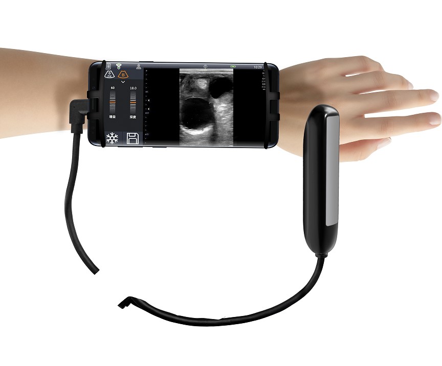 Ultrasonografy wielonarządowe weterynaryjne - USG ESAOTE MyLab TRINGA VET