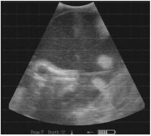 Ultrasonografy wielonarządowe weterynaryjne - USG ReproScan DVU60