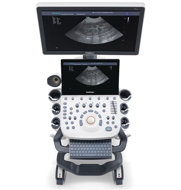 Ultrasonografy wielonarządowe weterynaryjne - USG SonoScape P20 VET