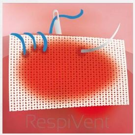 Utleniona celuloza (gaza hemostatyczna) Will-Pharma Willocell