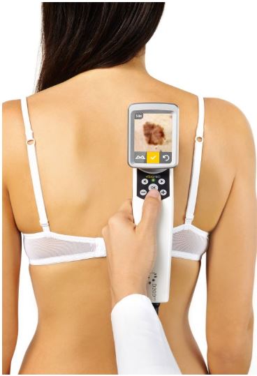 Videodermatoskopy CANFIELD D200 EVO
