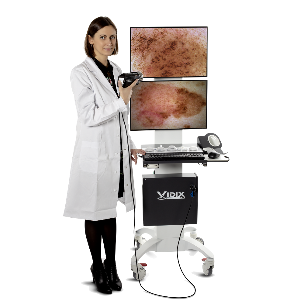 Videodermatoskopy Vidix Vidix 4