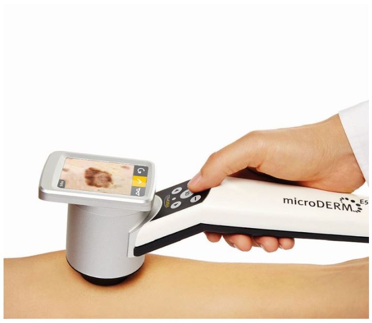 Videodermatoskopy Visiomed microDERM E50+