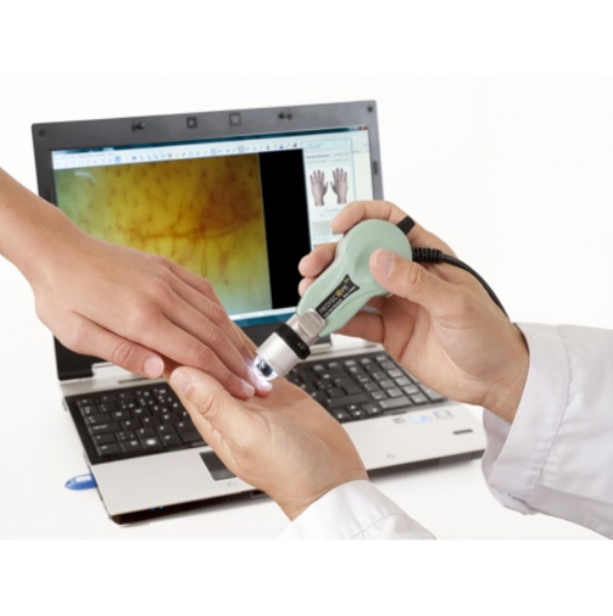 Videokapilaroskopy Optilia Instruments Optilia