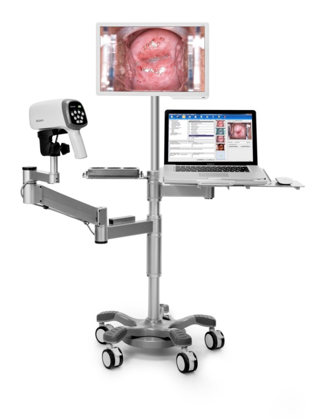 Wideokolposkopy (videokolposkopy) EDAN C6HD