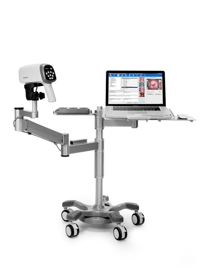 Wideokolposkopy (videokolposkopy) EDAN C6HD