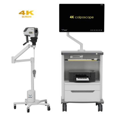 Wideokolposkopy (videokolposkopy) IKEDA Ikeda