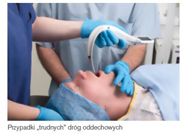 Wideolaryngoskopy do intubacji INTERSURGICAL i-view