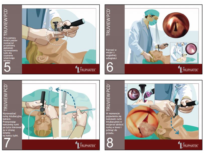 Wideolaryngoskopy do intubacji Truphatek Truview PCD