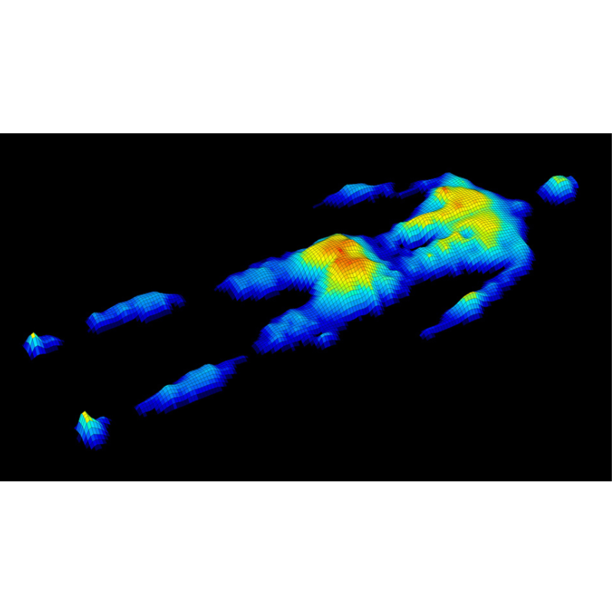 Wyposażenie stołów operacyjnych ALVO Medical SENSEi