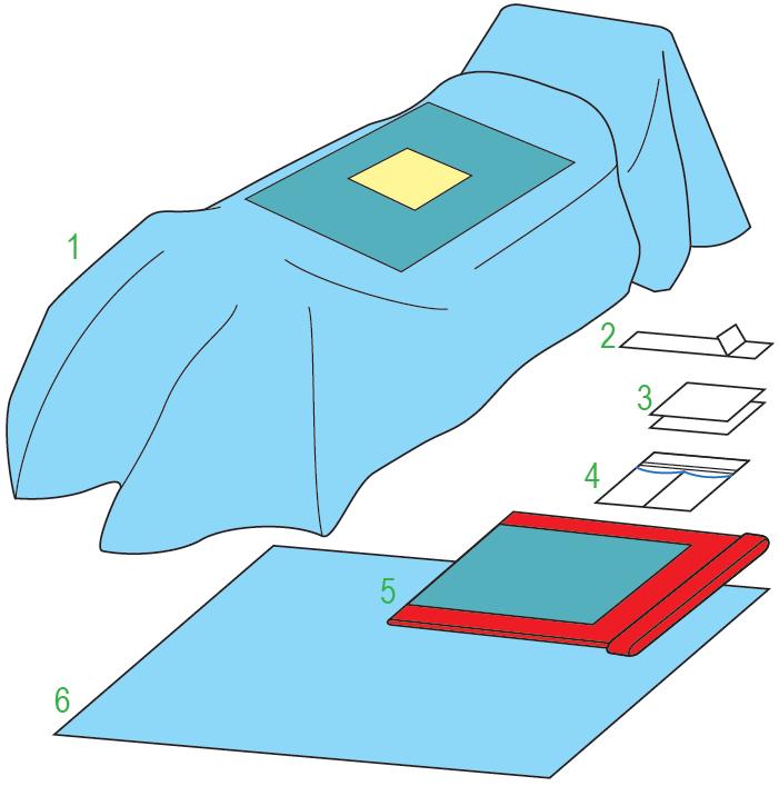 Zestawy do chirurgii ogólnej – obłożenia pola operacyjnego JKT/MOLNLYCKE Zestaw do laparotomii IV 380309