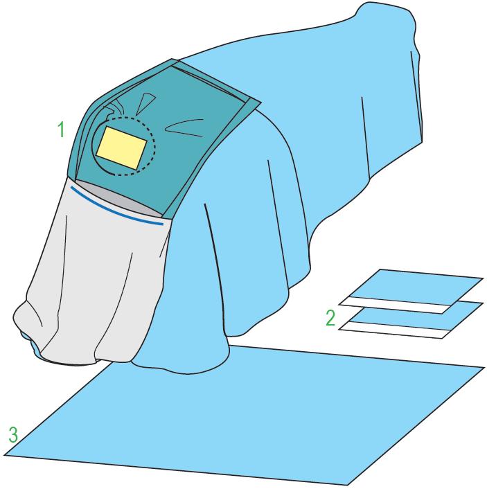 Zestawy do neurochirurgii – obłożenia pola operacyjnego JKT/MOLNLYCKE Zestaw do zabiegów neurochirurgicznych III 380426