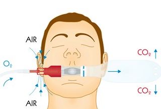 Zestawy do podawania tlenu do intubacji Flexicare Medical 032-10-540 / 032-10-640 / 032-10-740