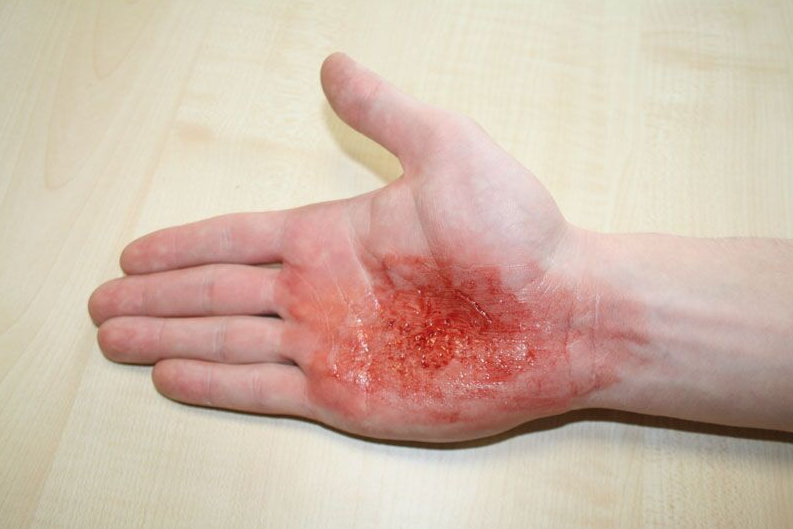 Zestawy do pozoracji ran 3B Scientific WS01