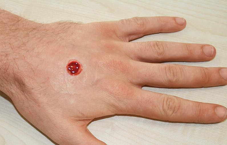 Zestawy do pozoracji ran 3B Scientific WS02