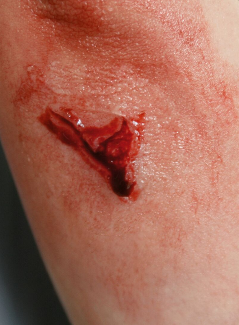 Zestawy do pozoracji ran 3B Scientific WS02