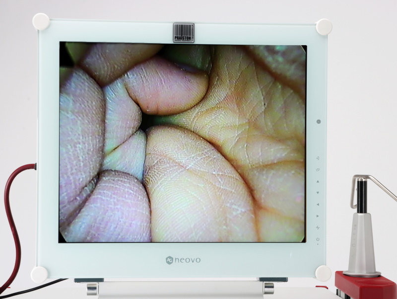 Zestawy endoskopowe używane B/D Richard Wolf - Praiston rekondycjonowany