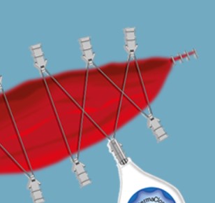 Ekspandery tkankowe do zamykania ran