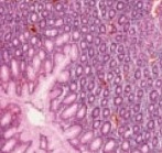 Przeciwciała (immunohistochemia)
