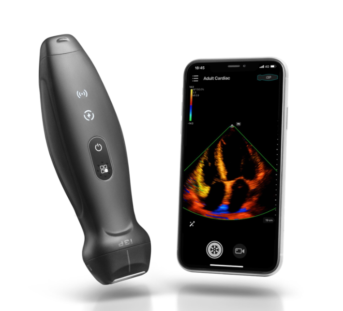 Ultrasonografy mobilne ręczne (USG)