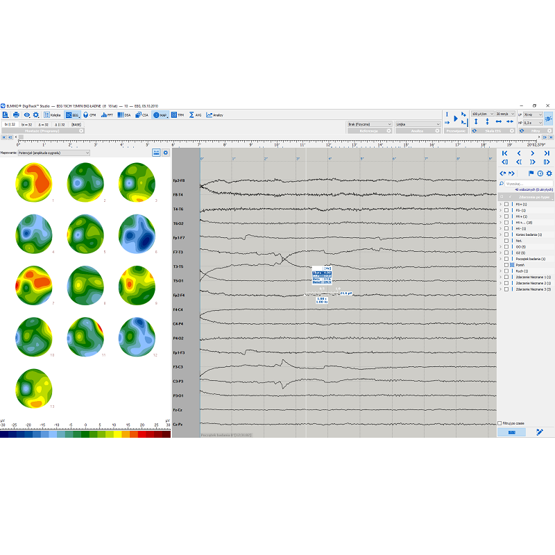 Oprogramowanie do analizy EEG