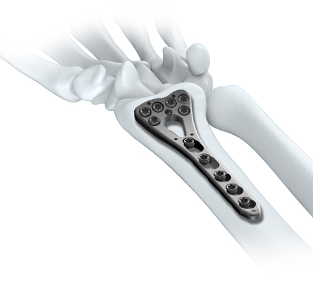 Ortopedia i traumatologia - sprzęt specjalistyczny