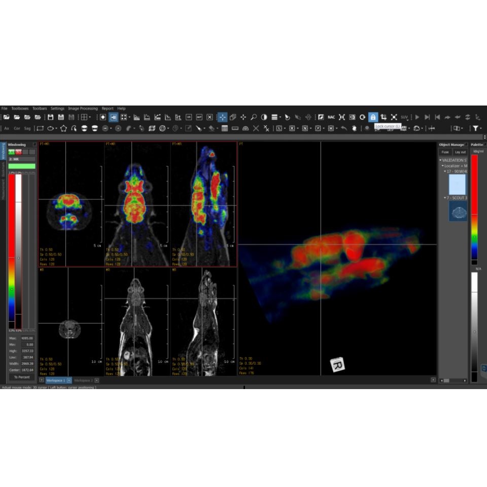 Oprogramowanie do diagnostyki obrazowej do medycyny nuklearnej