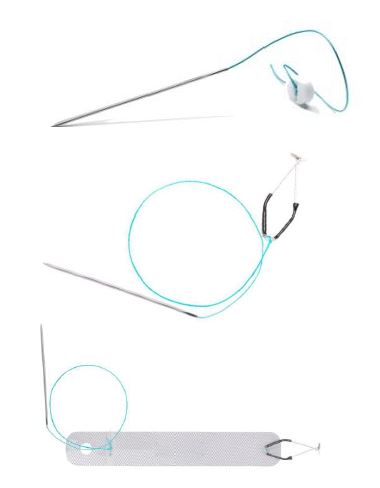 Retraktory laparoskopowe wewnętrzne jednorazowego użytku