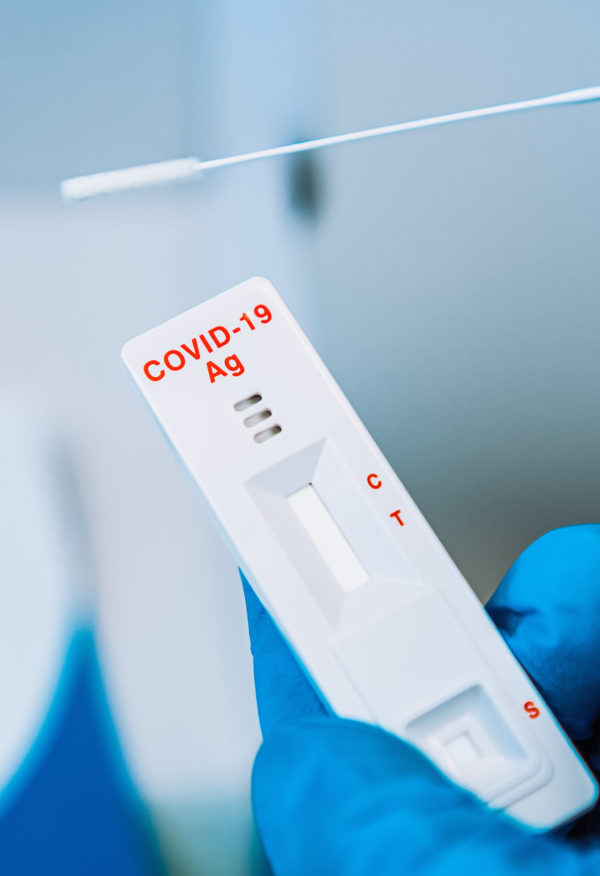 Testy do wykrywania przeciwciał koronawirusa SARS-CoV-2 COVID-19