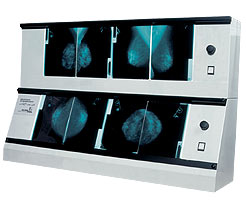 Negatoskopy mammograficzne